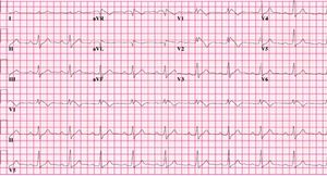 Syncopal Episode in an Otherwise Healthy 15-Year-Old Boy
