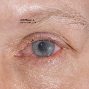 ©ARZTSAMUI/shutterstock.com