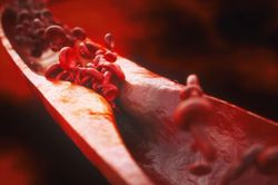 Evolocumab Associated with Lower Long-term Cardiovascular Event Risk in Real-world Study of More Than 110 000 Patients