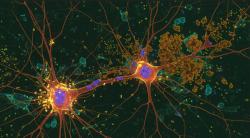 AAIC 2025 to Feature Lecanemab Data on Long-Term Efficacy, Real-World Use, and Maintenance Dosing