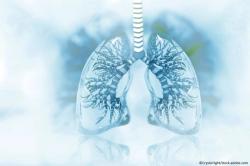 Exacerbation History as Sole COPD Risk Predictor May be Flawed, Associated with Risk of Harm