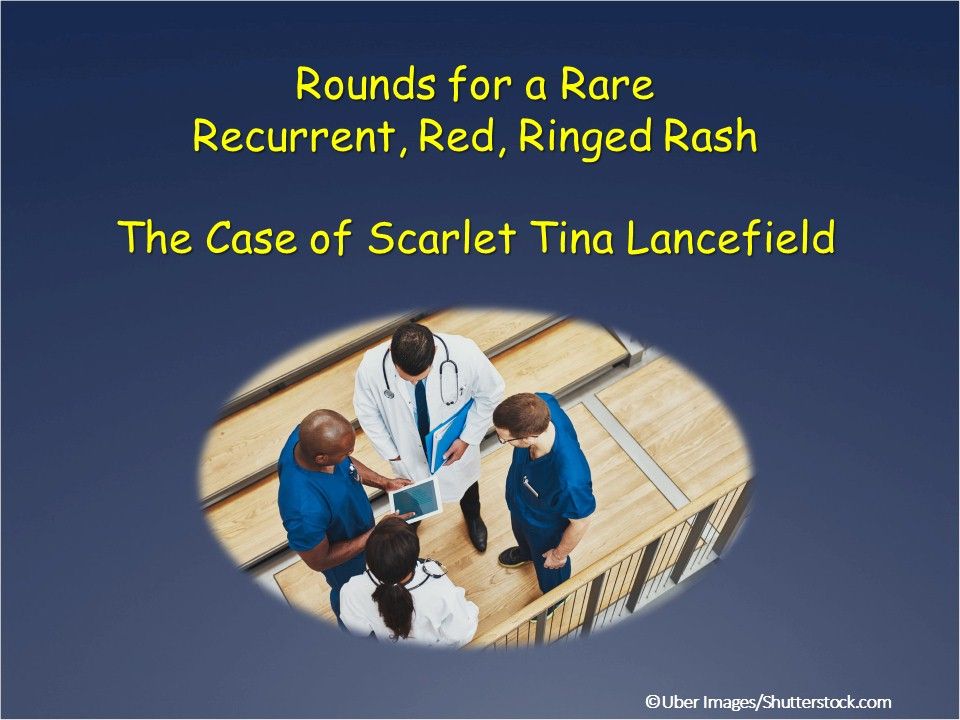 A Rare, Recurrent, Red, Ringed Rash