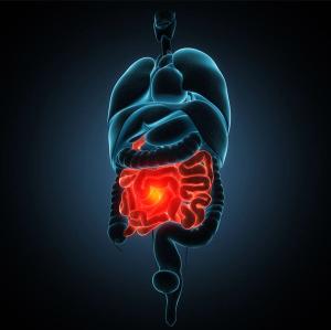 FDA Approves Updated Indication Statement for Upadacitinib in Inflammatory Bowel Disease Treatment / Image credit: ©unlimit3d/AdobeStock