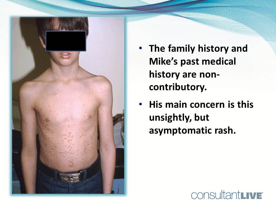 A scaly rash is asymptomatic. PMH noncontributory. 