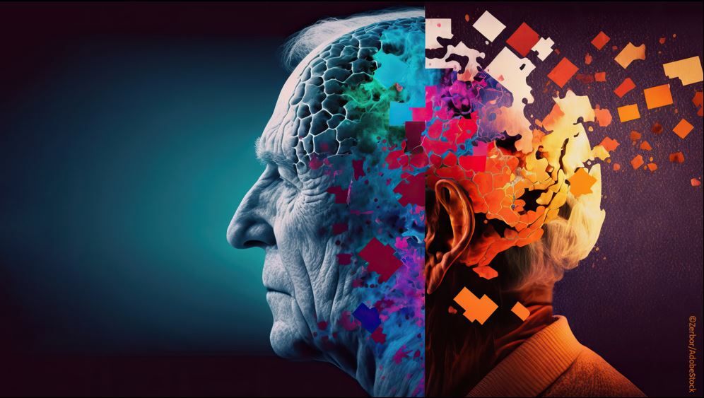 FDA Grants Fast Track Designation to Anti-Tau Antibody BMS-986446 for Alzheimer Disease / Image credit: ©Zerbor/AdobeStock