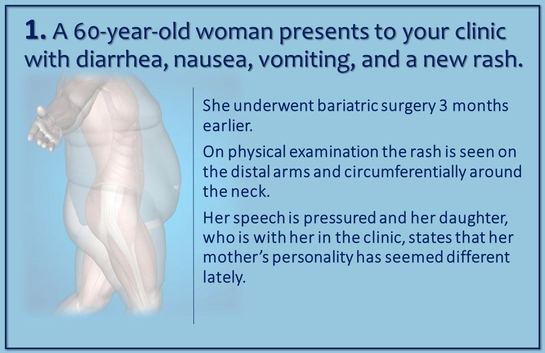 bariatric surgery, post bariatric surgery, nutritional deficiency, primary care