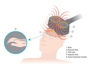NeuroStim Announces Single-Day TMS Protocol With High Remission Rates in Depression / image credit ©PATTARAWIT/stock.adobe.com