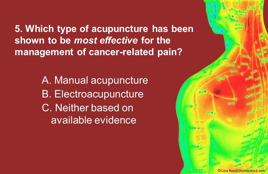 Acupuncture for the Management of Cancer Related-Pain