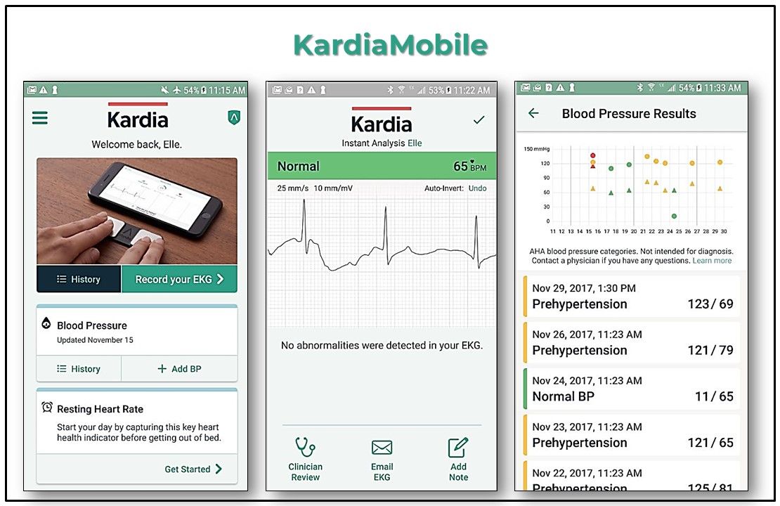 kardia mobile, kardia app, kardia mobile ekg, primary care, medical apps, FDA