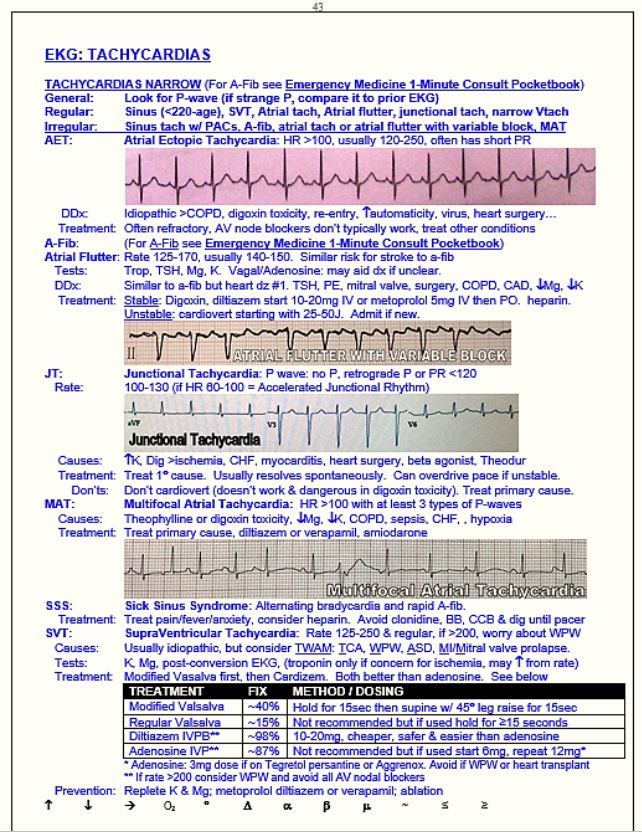 Supraventricular Tachycardia with Aberrancy | Patient Care Online Supraventricular Tachycardia with Aberrancy | Patient Care Online