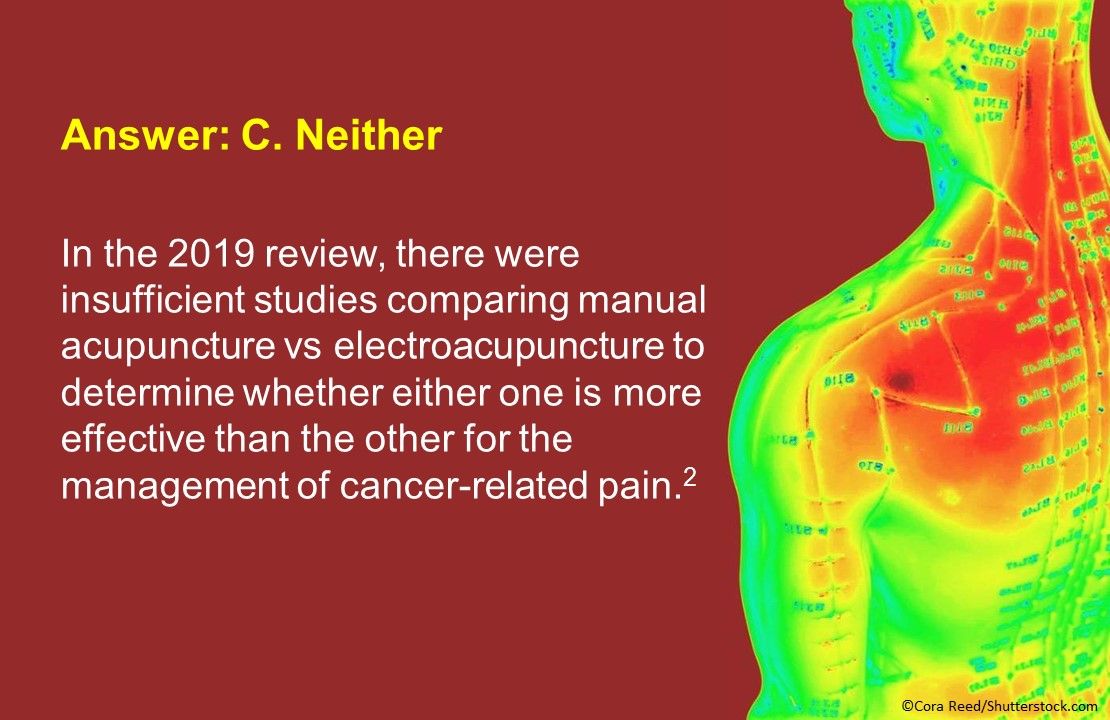 Acupuncture for the Management of Cancer Related-Pain