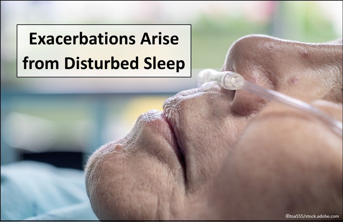 COPD, COPD exacerbation, sleep quality, primary care, COPD new research