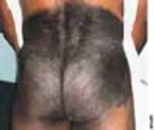 Mongolian Spots: Two Views