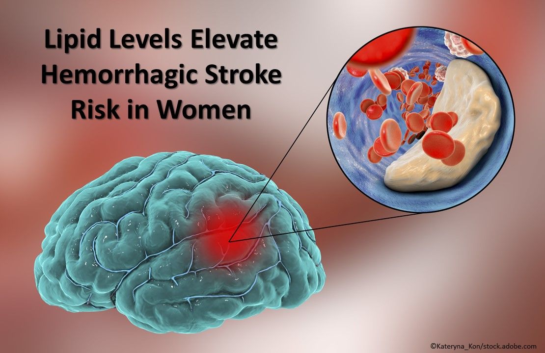 7 New Developments in Women's Health, hemorrhagic stroke, LDL-C, triglyceride