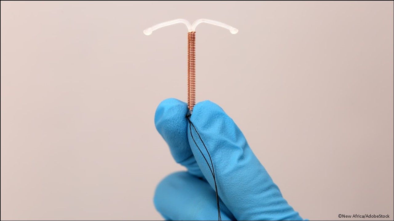 Pregnancy prevention: Miudella copper-containing intrauterine system indicated for prevention of pregnancy