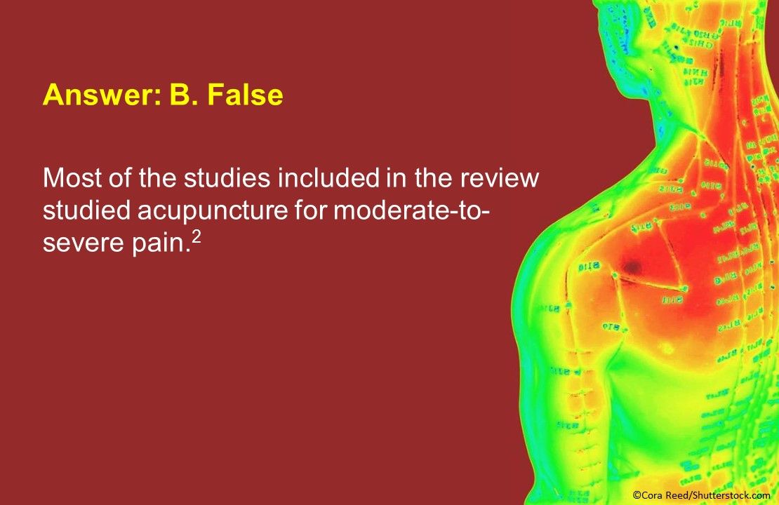 Acupuncture for the Management of Cancer Related-Pain