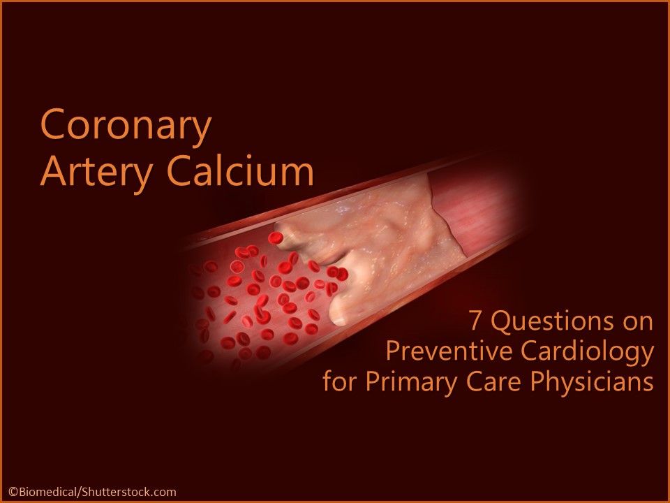 Consider Coronary Artery Calcium 7 Questions