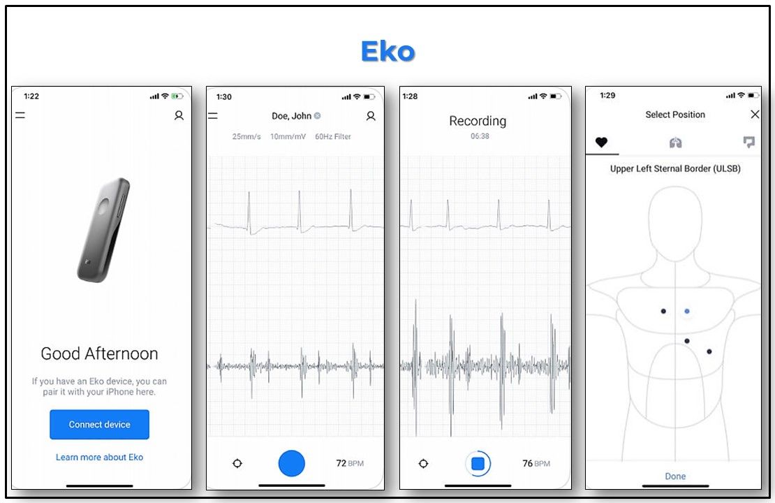 Eko Digital Stethoscope, Eko mobile app, primary care, medical apps, FDA cleared