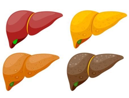 Investigational GPR119 Agonist Shows Dual Hepatoprotective and Glycemic Benefits in MASH Patients / image credit  ©Wowow/stock.adobe.com