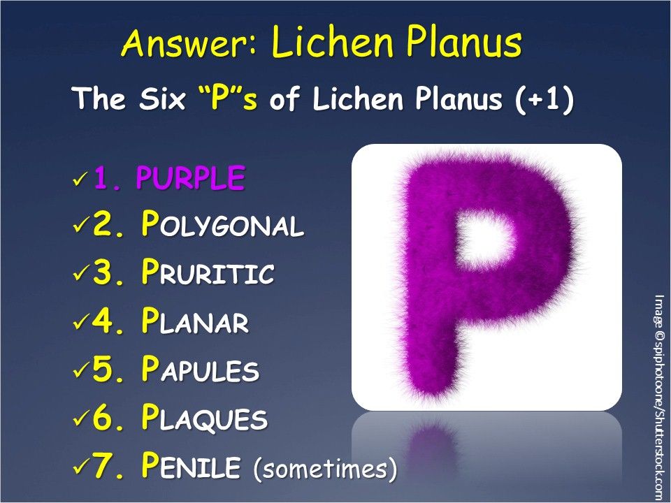 A Pruritic, Polygonal, Papular, Rash on a 10-year-old Boy