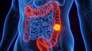 Targeted Intervention Boosts Colorectal Cancer Screening Rates among US Adults / Image credit: ©Sebastian Kaulitzky/AdobeStock