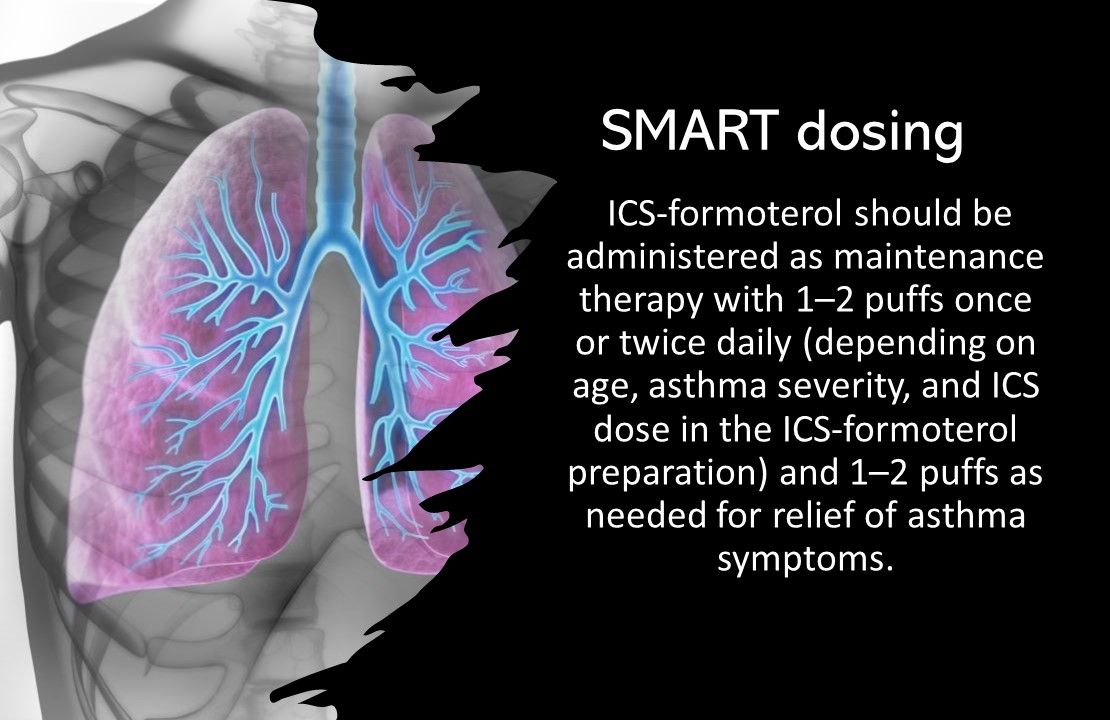 Single Maintenance & Reliever Therapy for Asthma: Guideline Toplines