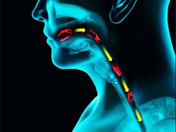 Minimally Invasive Esophageal String Test Used to Monitor Eosinophilic Esophagitis in Children / Image credit: ©Naeblys/AdobeStock