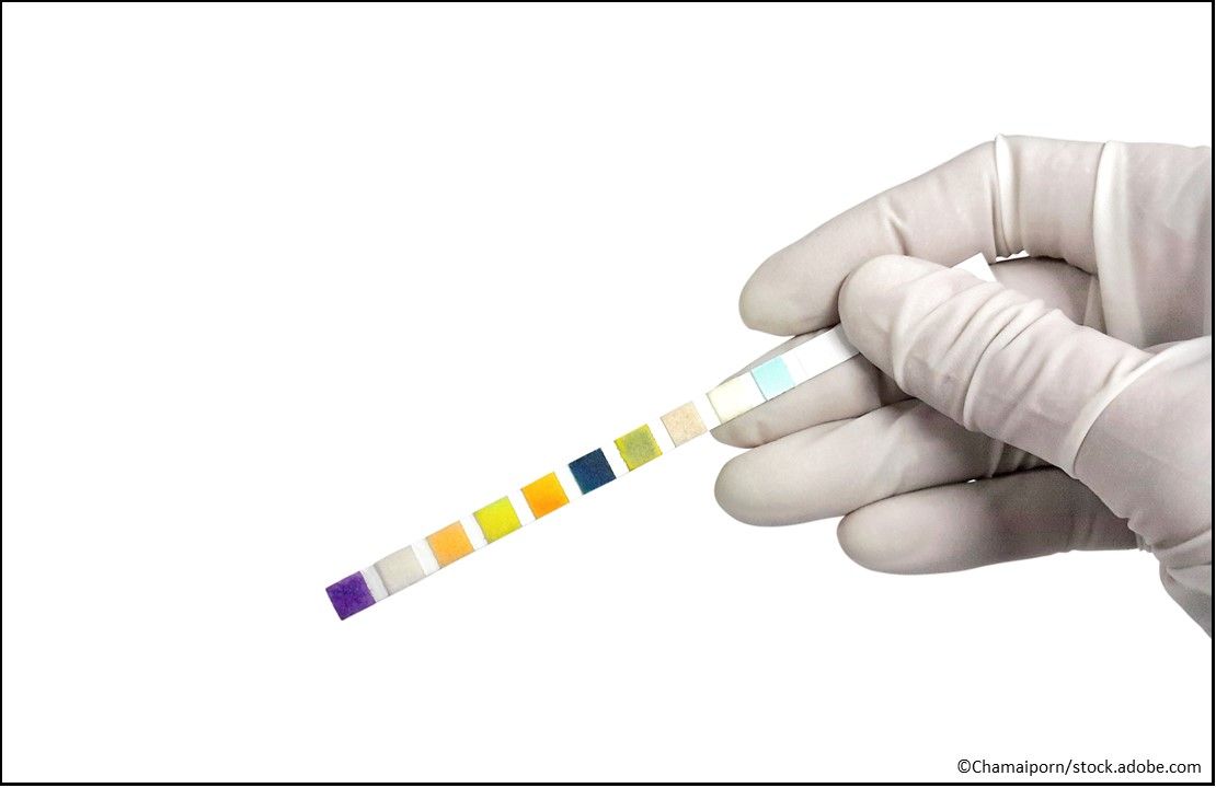 Urinary Tract Infection, Intraabdominal Infection, Recarbrio injection, UTI