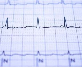 Updated Guidelines for Atrial Fibrillation from ACC/AHA Focus on Aggressive Prevention and Control and a Continuum of Care / image credit AF ecg ©Horacio Selva/stock.adobe.com