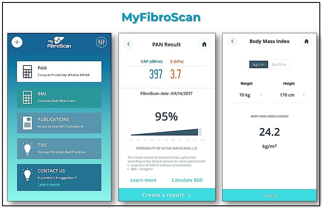 MyFibroScan is available at iTunes and Google Play, FibroScan, liver disease