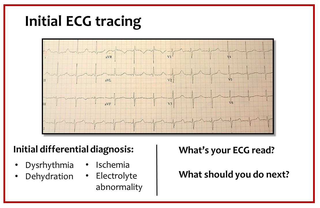 Palpitations in Young People: 2 ECG Challenges | Patient Care