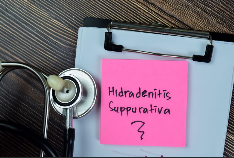 Early Biologic Therapy for Hidradenitis Suppurativa Supported by Majority of Specialists, Survey Shows / image credit: ©syahrir/AdobeStock
