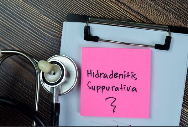Early Biologic Therapy for Hidradenitis Suppurativa Supported by Majority of Specialists, Survey Shows / image credit: ©syahrir/AdobeStock