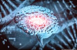 Largest Genetic Study of Migraine to Date Identifies New Risk Factors