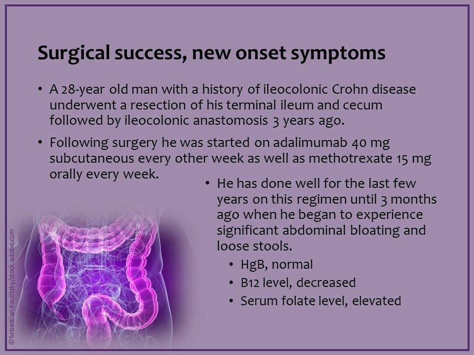 Ileocolic Crohn disease, ileocolic resection, ileocolonic resection 