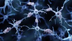 Lecanemab Shows Sustained Benefit at 4 Years in Early Alzheimer Disease: AAIC 2025