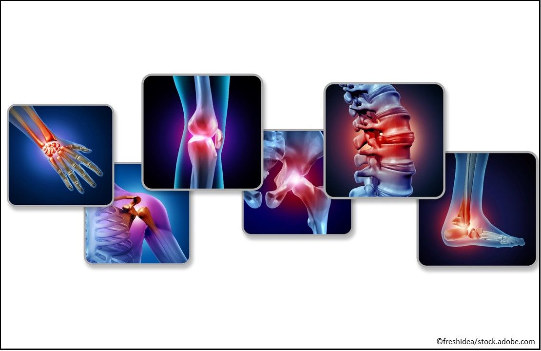 Inflammatory Diseases, Hadlima, biosimilar to Humira, arthritis, Crohn disease