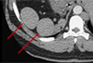 Pseudomonas Enteritis in an Unlikely Host