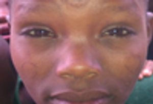 Child Abuse-or Cultural Norm?-in a Developing Nation