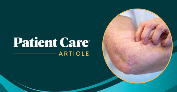 FDA Grants Priority Review to Zasocitinib for Plaque Psoriasis / image credit: MJH Life Sciences
