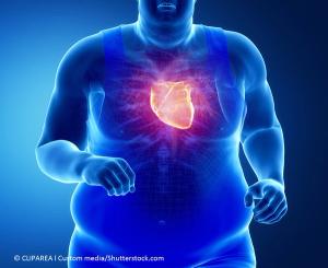 Obesity in Primary Care: The Comorbidities