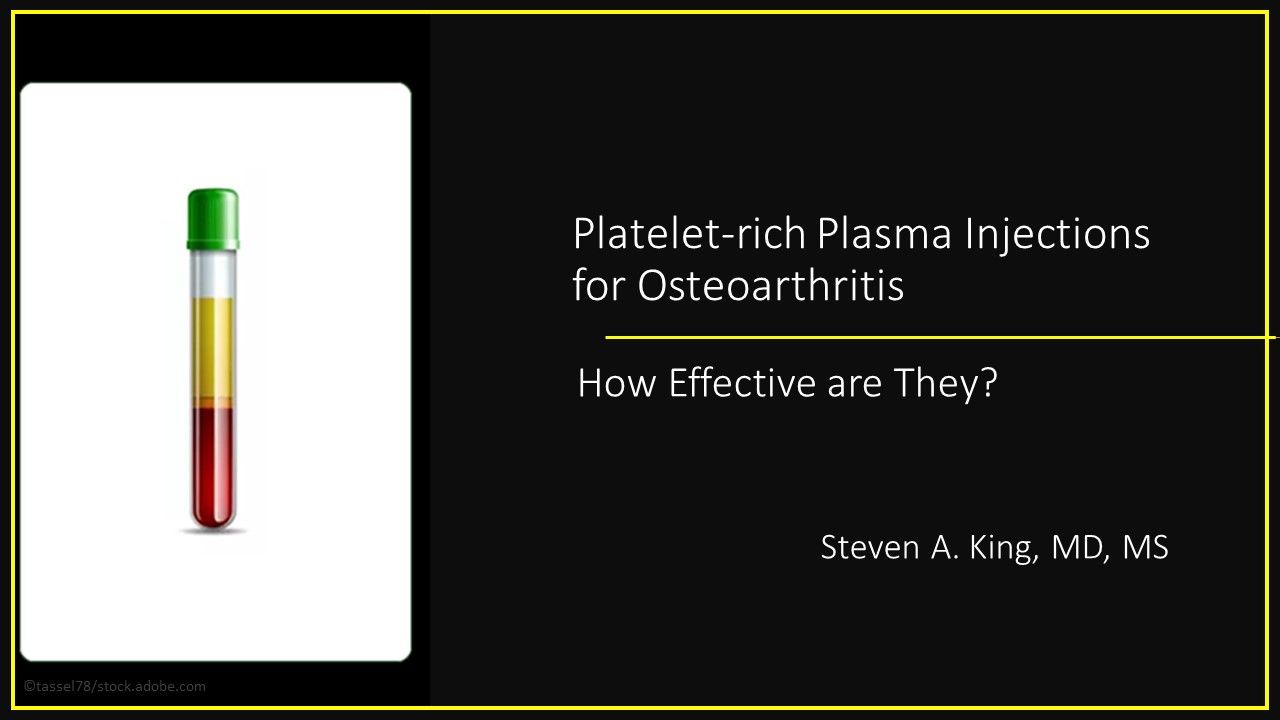 Plateletrich Plasma Injections for Osteoarthritis How Effective Are They?