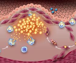 Progression of Subclinical Atherosclerosis Independently Predicts All-Cause Mortality 