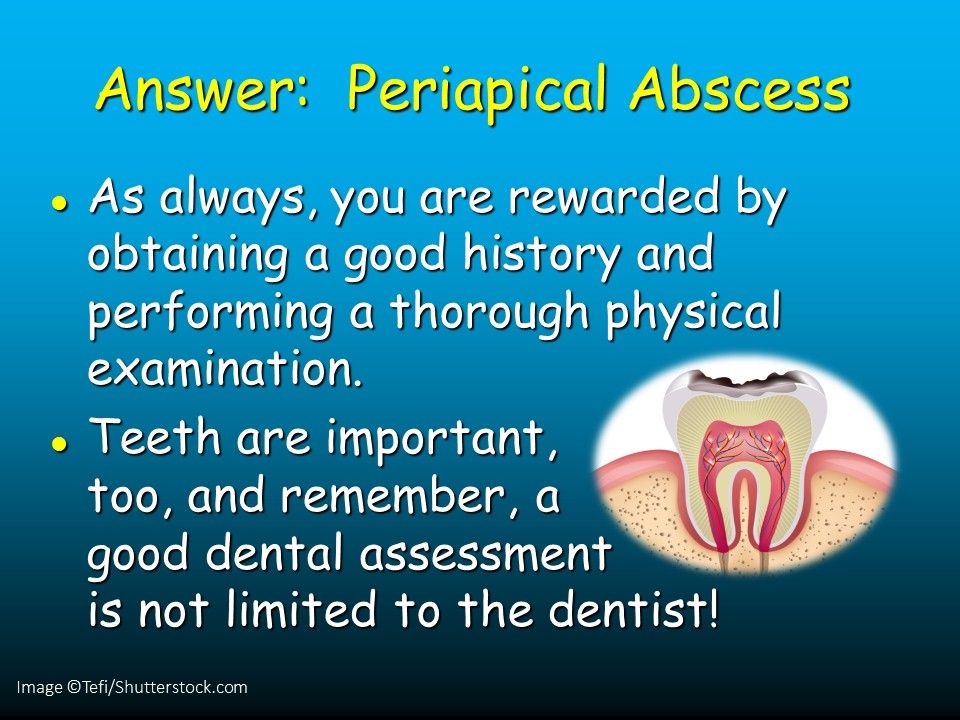 "Lumpy Jaw" in a 20yearold Male Resists Treatment Patient Care Online