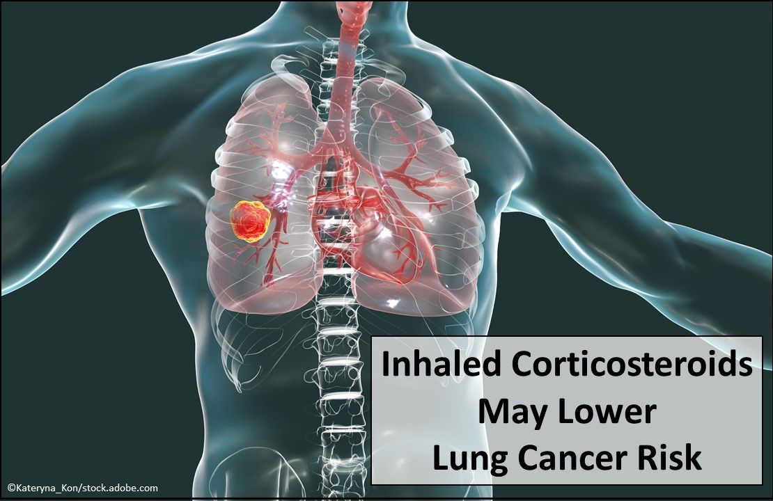 COPD, lung cancer, lung cancer risk factors, lung cancer diagnosis, primary care