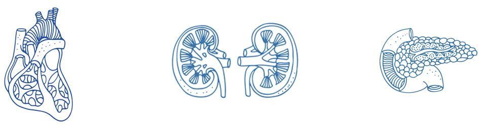 Inhibidor de SGLT-2 HF, beneficio CV encontrado consistente entre poblaciones con T2D, CKD, HF