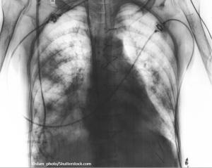 Copyright sfam_photo/Shutterstock.com 