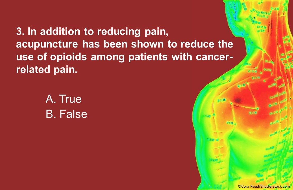 Acupuncture for the Management of Cancer Related-Pain