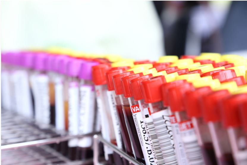 Routine Laboratory Study Results Not Clinically Useful for Diagnosing Long COVID: New Analysis / Image credit:©THALERNGSAK_MONGKOLSIN/Shutterstock.com