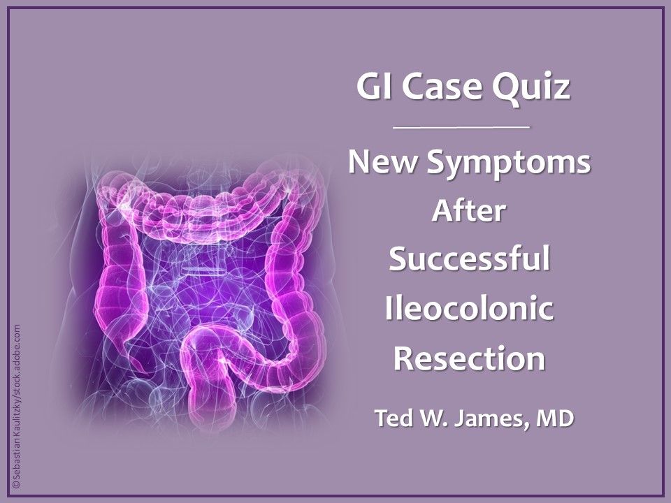 Ileocolic Crohn disease, ileocolic resection, ileocolonic resection 